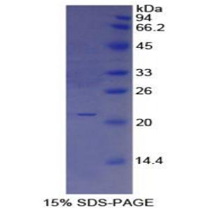白介素25(IL25)重组蛋白