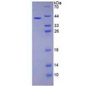 白介素26(IL26)重组蛋白