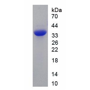 白介素27(IL27)重组蛋白