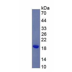 白介素31(IL31)重组蛋白