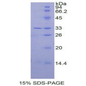 白介素31受体A(IL31RA)重组蛋白,Recombinant Interleukin 31 Receptor A (IL31RA)
