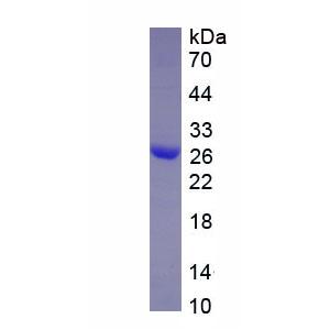 白介素34(IL34)重组蛋白