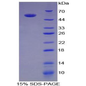 白介素35(IL35)重组蛋白