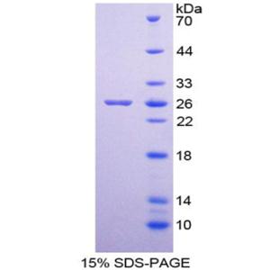 白介素增强子结合因子3(ILF3)重组蛋白,Recombinant Interleukin Enhancer Binding Factor 3 (ILF3)