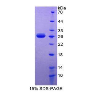 白细胞衍生趋化因子1(LECT1)重组蛋白