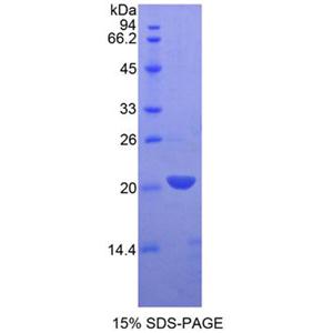 白细胞衍生趋化因子2(LECT2)重组蛋白