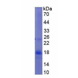 斑联蛋白(ZYX)重组蛋白,Recombinant Zyxin (ZYX)