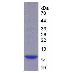 半胱氨酸蛋白酶抑制剂4(CST4)重组蛋白