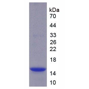 半胱氨酸蛋白酶抑制劑4(CST4)重組蛋白