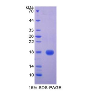 半胱氨酸蛋白酶抑制剂5(CST5)重组蛋白