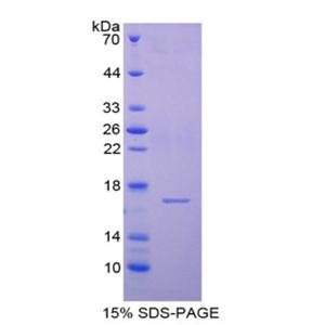 半胱氨酸蛋白酶抑制剂6(CST6)重组蛋白