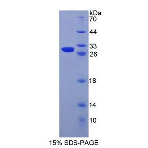 半胱氨酸豐富分泌蛋白1(CRISP1)重組蛋白