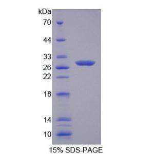半胱氨酸豐富分泌蛋白2(CRISP2)重組蛋白