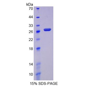 半胱氨酸双加氧酶Ⅰ(CDO1)重组蛋白