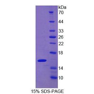 半乳糖凝集素9C(GAL9C)重组蛋白,Recombinant Galectin 9C (GAL9C)