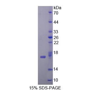 胞苷脱氨酶(CDA)重组蛋白