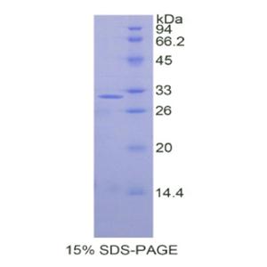 胞裂蛋白5(SEPT5)重组蛋白,Recombinant Septin 5 (SEPT5)