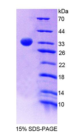 吡哆胺-5'-磷酸氧化酶(PNPO)重组蛋白,Recombinant Pyridoxamine-5'-Phosphate Oxidase (PNPO)