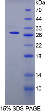 表面活性物质关联蛋白A2(SPA2)重组蛋白,Recombinant Surfactant Associated Protein A2 (SPA2)
