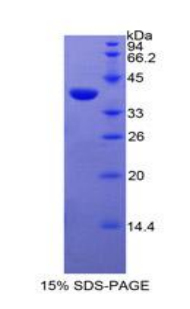 表皮生长因子受体(EGFR)重组蛋白,Recombinant Epidermal Growth Factor Receptor (EGFR)