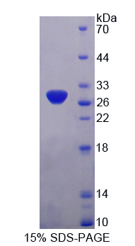 丙酮酸脱氢酶复合体成分X(PDHX)重组蛋白,Recombinant Pyruvate Dehydrogenase Complex Component X (PDHX)