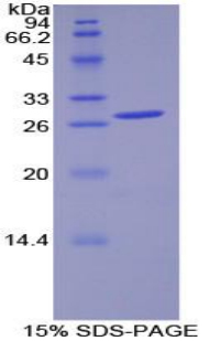 丙酮酸脱氢酶激酶同工酶1(PDK1)重组蛋白,Recombinant Pyruvate Dehydrogenase Kinase Isozyme 1 (PDK1)