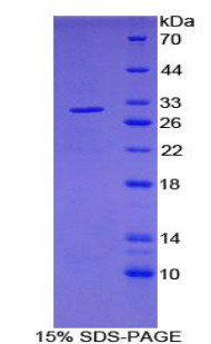 丙酮酸脱氢酶磷酸酶(PDP)重组蛋白,Recombinant Pyruvate Dehydrogenase Phosphatase (PDP)