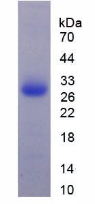 补体成分1q子成分A(C1qA)重组蛋白,Recombinant Complement Component 1, Q Subcomponent A (C1qA)