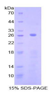 补体成分2(C2)重组蛋白,Recombinant Complement Component 2 (C2)