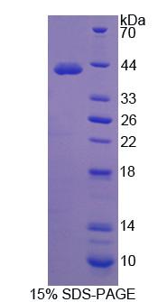 补体成分4a(C4a)重组蛋白,Recombinant Complement Component 4a (C4a)