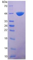 补体成分7(C7)重组蛋白,Recombinant Complement Component 7 (C7)