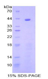 补体成分8β(C8b)重组蛋白,Recombinant Complement Component 8b (C8b)