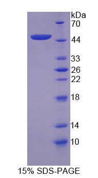 補(bǔ)體成分8γ(C8g)重組蛋白,Recombinant Complement Component 8g (C8g)