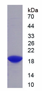 补体因子H相关蛋白1(CFHR1)重组蛋白,Recombinant Complement Factor H Related Protein 1 (CFHR1)