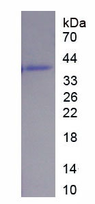 补体因子H相关蛋白3(CFHR3)重组蛋白,Recombinant Complement Factor H Related Protein 3 (CFHR3)