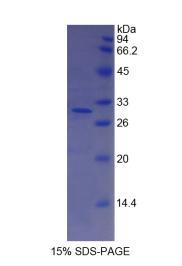 補體因子I(CFI)重組蛋白,Recombinant Complement Factor I (CFI)