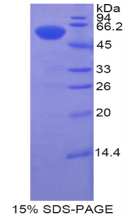 布鲁东氏酪氨酸激酶(Btk)重组蛋白,Recombinant Bruton'S Tyrosine Kinase (Btk)