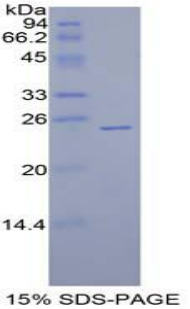 侧支发芽因子同源物1(SPRY1)重组蛋白,Recombinant Sprouty Homolog 1 (SPRY1)