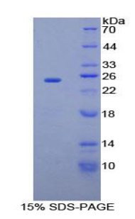 侧支发芽因子同源物2(SPRY2)重组蛋白,Recombinant Sprouty Homolog 2 (SPRY2)