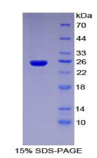 侧支发芽因子同源物3(SPRY3)重组蛋白,Recombinant Sprouty Homolog 3 (SPRY3)