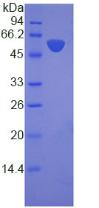 層粘連蛋白β3(LAMb3)重組蛋白,Recombinant Laminin Beta 3 (LAMb3)