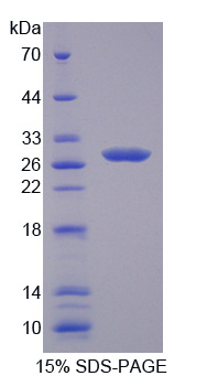 層粘連蛋白β4(LAMb4)重組蛋白,Recombinant Laminin Beta 4 (LAMb4)