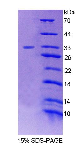 叉头框蛋白O3(FOXO3)重组蛋白,Recombinant Forkhead Box Protein O3 (FOXO3)