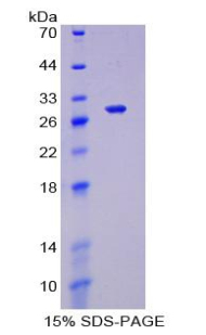 叉头框蛋白P1(FOXP1)重组蛋白,Recombinant Forkhead Box Protein P1 (FOXP1)