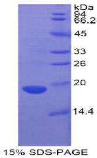 肠型脂肪酸结合蛋白(FABP2)重组蛋白,Recombinant Fatty Acid Binding Protein 2, Intestinal (FABP2)