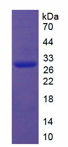 沉默調(diào)節(jié)蛋白1(SIRT1)重組蛋白,Recombinant Sirtuin 1 (SIRT1)