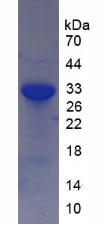 沉默调节蛋白2(SIRT2)重组蛋白,Recombinant Sirtuin 2 (SIRT2)