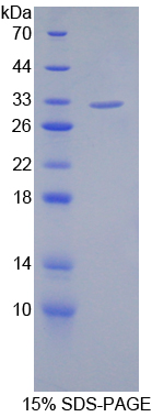 沉默调节蛋白3(SIRT3)重组蛋白,Recombinant Sirtuin 3 (SIRT3)