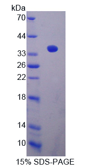 沉默调节蛋白4(SIRT4)重组蛋白,Recombinant Sirtuin 4 (SIRT4)
