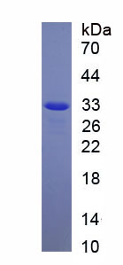 沉默調(diào)節(jié)蛋白6(SIRT6)重組蛋白,Recombinant Sirtuin 6 (SIRT6)